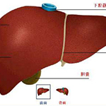保护肝脏 远离肝癌威胁