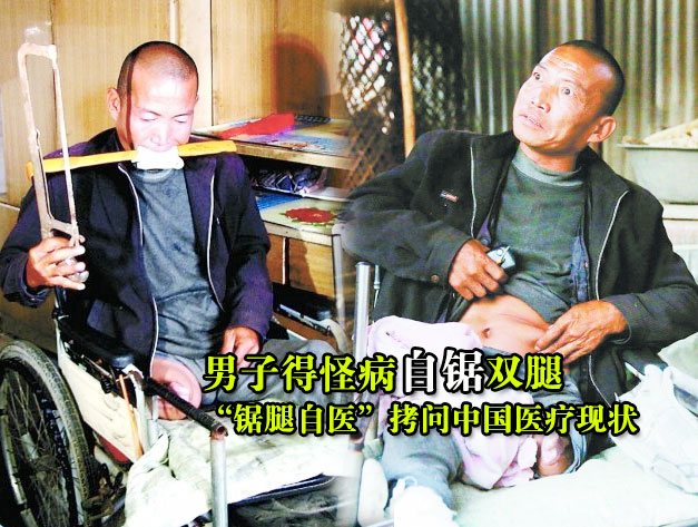 男子得怪病自锯双腿 “锯腿自医”拷问中国医疗现状